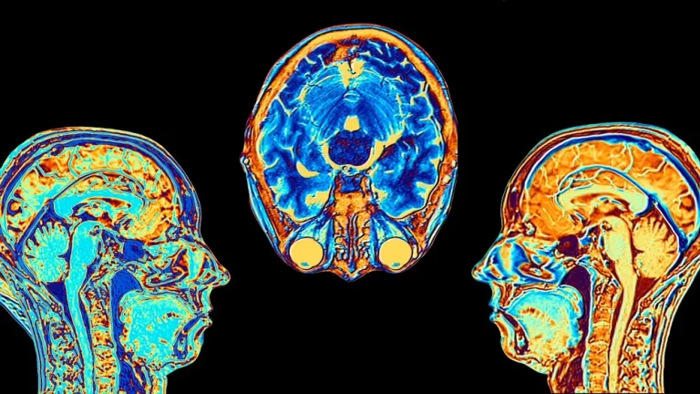 gettyimages-758303599webp